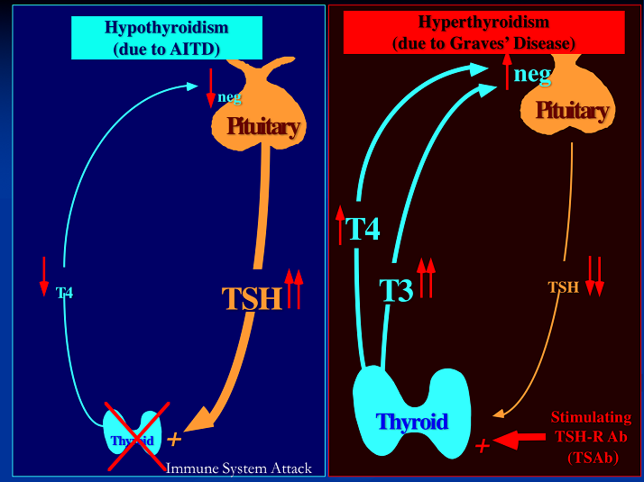 Hyperthyroidism (due to AITD) and Hyperthyroidism (due to Graves