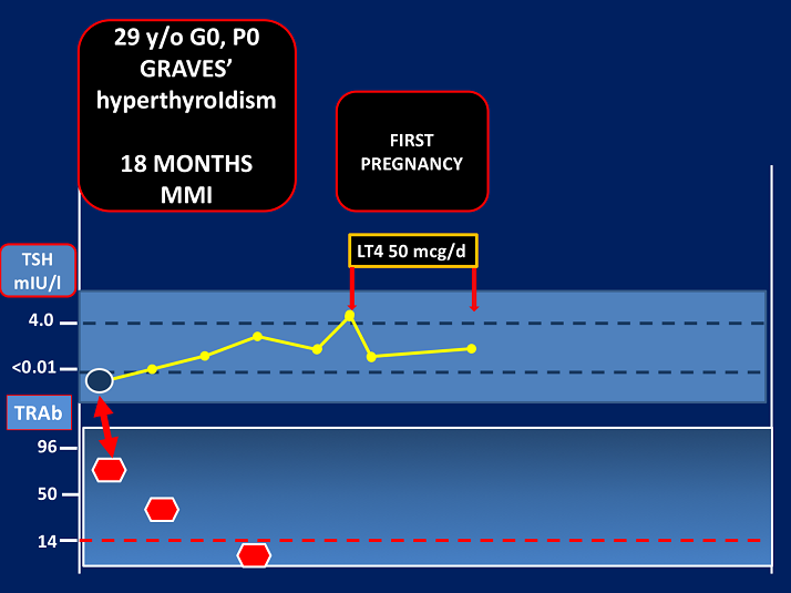 18 months MMI First Pregnancy Clinical Relevance and Utility of TSH