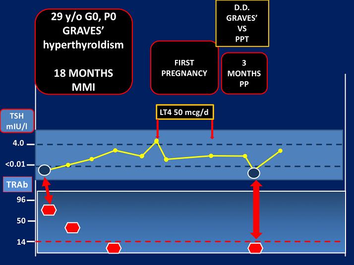 D.D. Graves' vs PPT Clinical Relevance and Utility of TSHR
