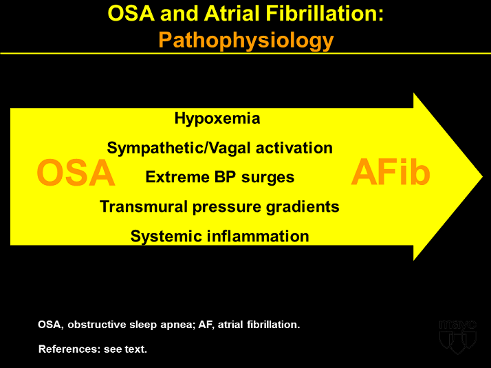 Osa And A Fib: Pathophysiology - Sleep Apnea And Cardiovascular Disease -  Activity One:&lt;Br&gt;Servo Ventilation Therapy For Sleep Disordered Breathing  Resource Center