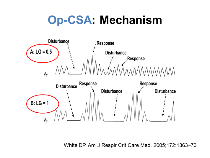 Mechanism High vs Low Loop Gain OpioidInduced Central Apnea and