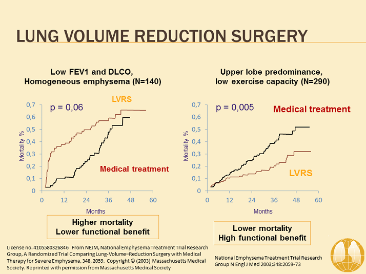 Lung Volume Reduction Surgery Overview of Therapeutic Options GOLD