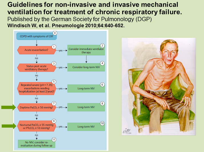 Guidelines for NonInvasive and Invasive Mechanical Ventilation for