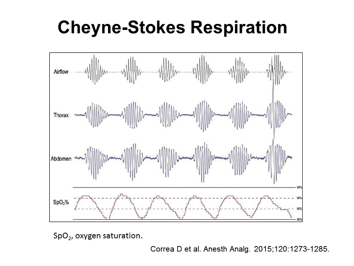 Cheyne Stokes Breathing Pattern