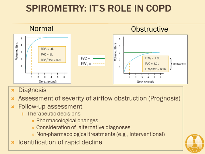 Spirometry It's Role in COPD Diagnosis and Assessment of COPD GOLD