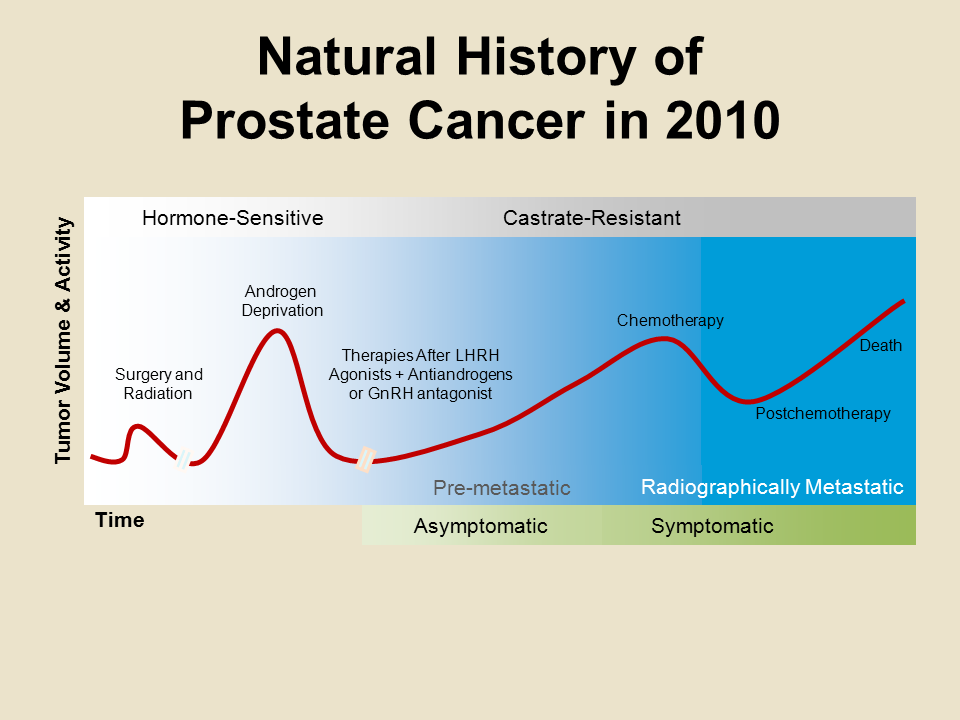 asymptomatic prostate cancer)