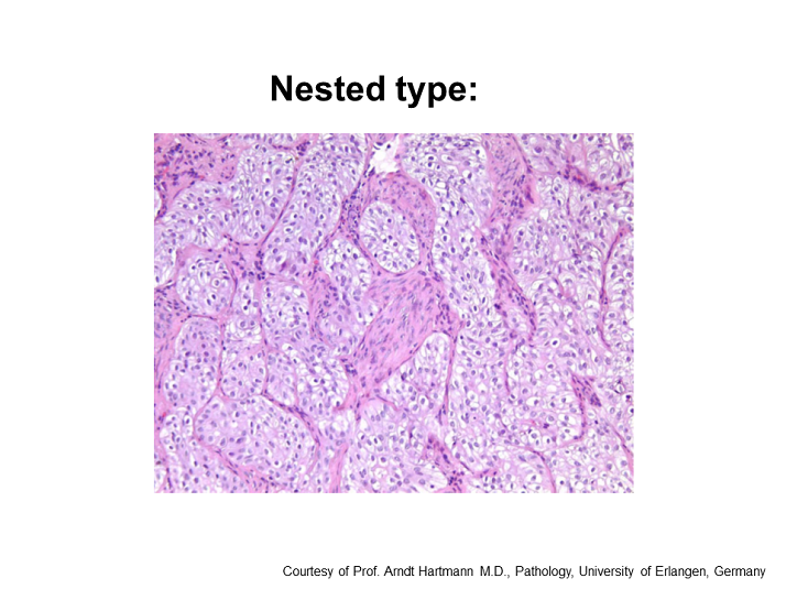 Educational CentreCurrent Clinical Problems in Bladder Cancer