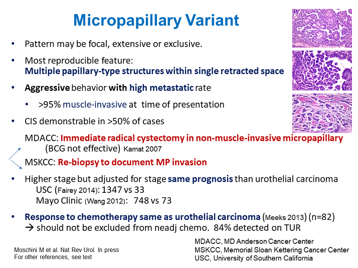 Micropapillary Variant Activity Six Management of T1 Highgrade