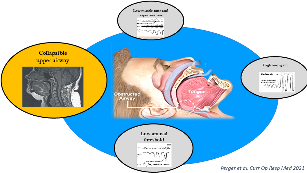The Mask & Beyond: Personalized and Individualized Approaches to Sleep ...