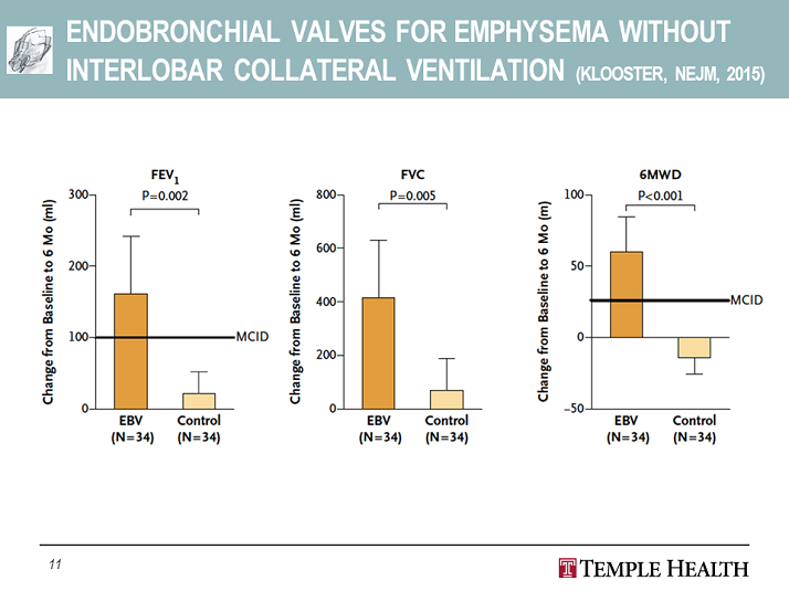 Endobronchial Valves for Emphysema Without Interlobar Collateral