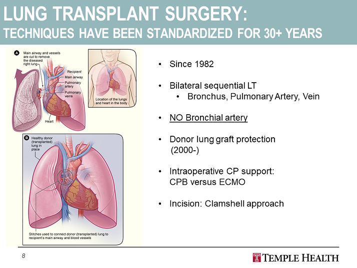 Lung Transplant Surgery: Techniques have been standardized for 30+ years - Surgical Approach To Lung Transplant - Temple Lung Center: Learning Center