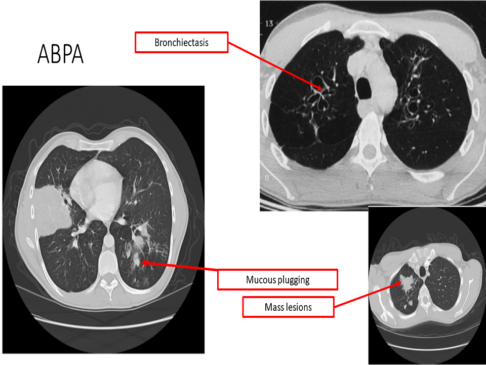 Temple Lung Center Learning Center