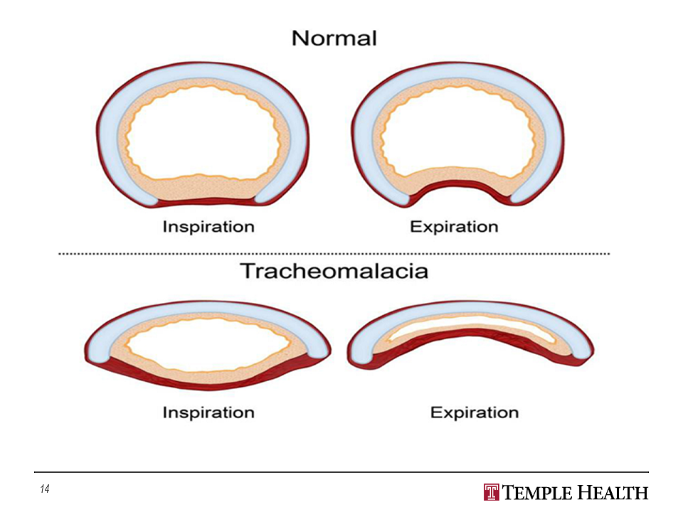 Temple Lung Center Learning Center